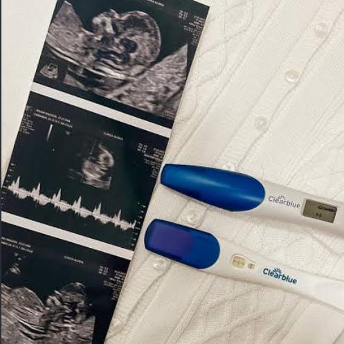 🤰🏽👣Gestantes e tentantes 🩷🩵🤰🏽👣